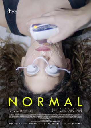 Normal