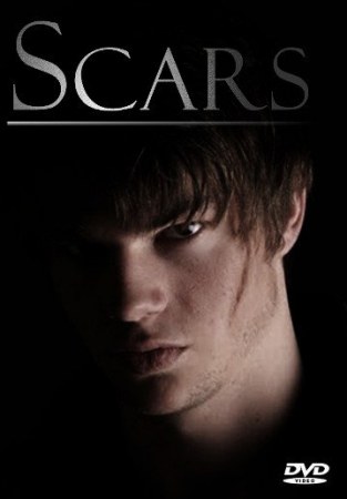 Scars