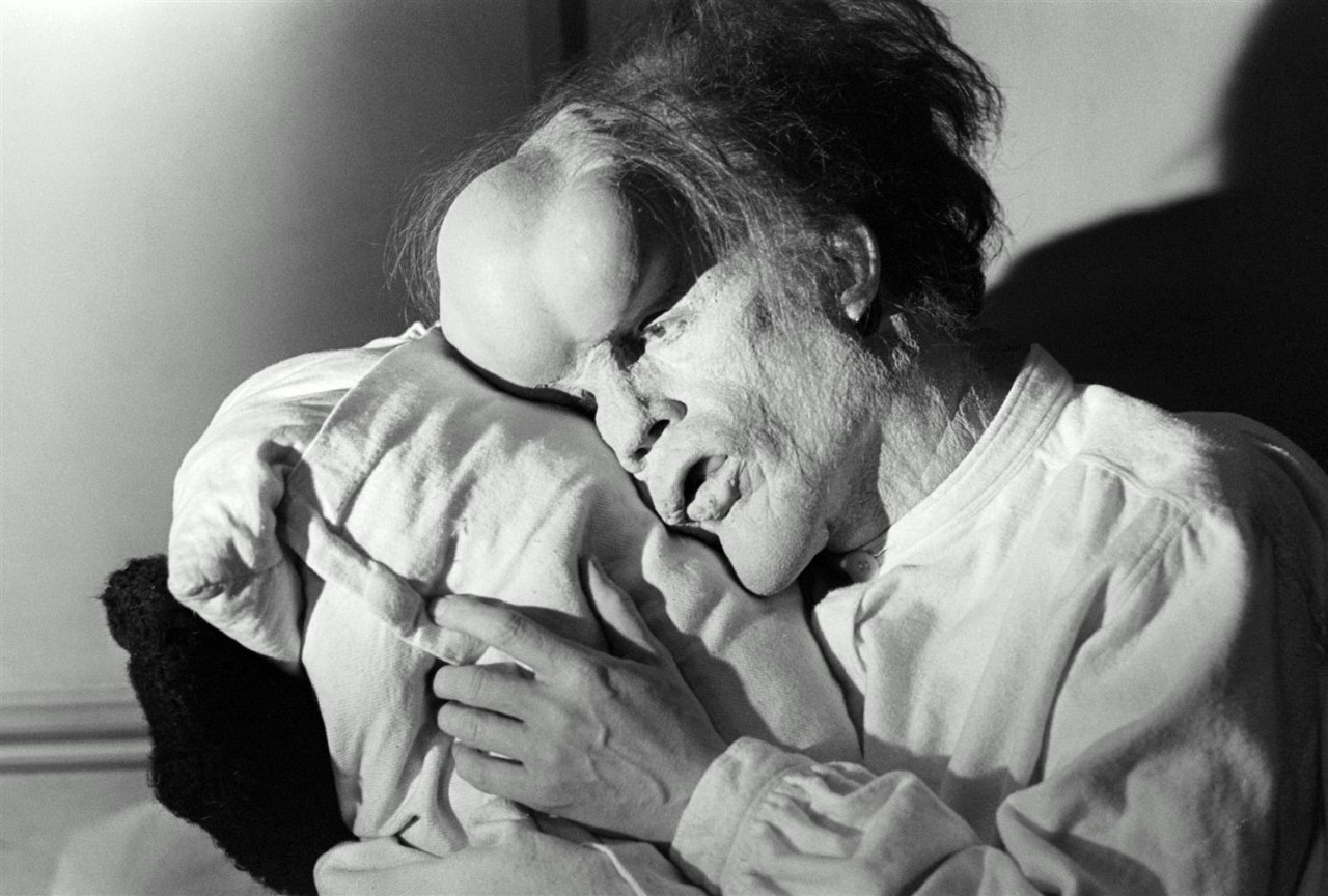 Der Elefantenmensch - Bild 7